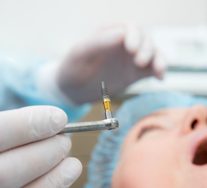 Dentist holding a dental implant right before surgically placing it in a patient