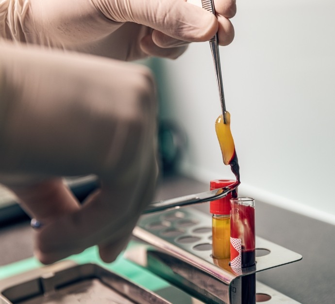 Dentist handling a tube with a blood sample