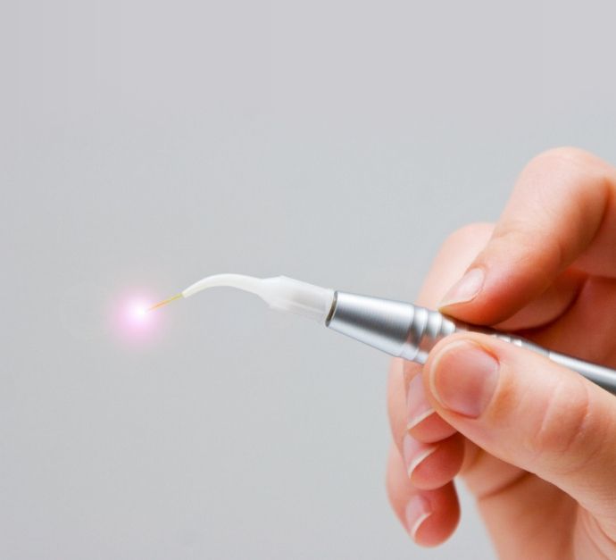 Hand holding a pen like dental laser device